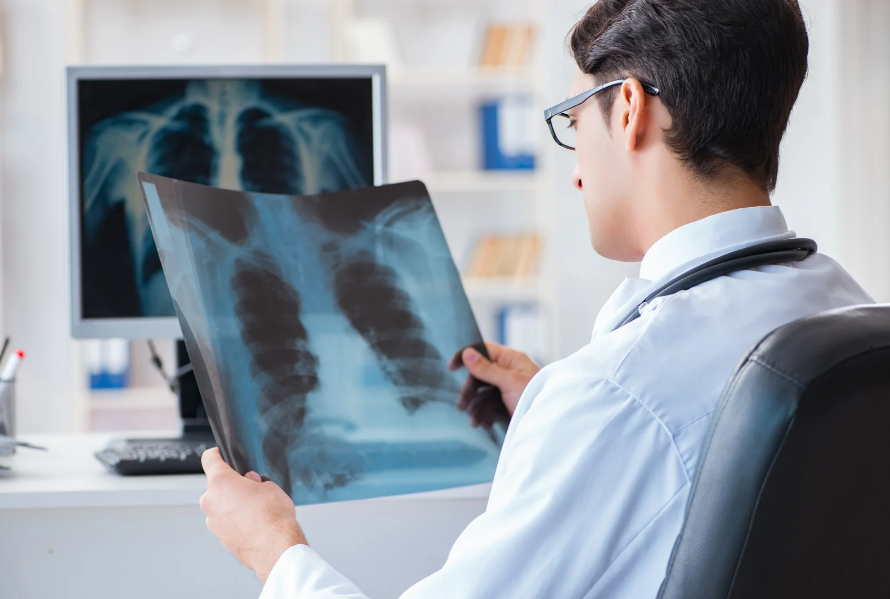 Smoker’s Health Screening