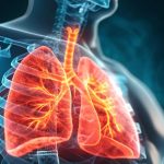 Health Screening - Smoker's Screening Package