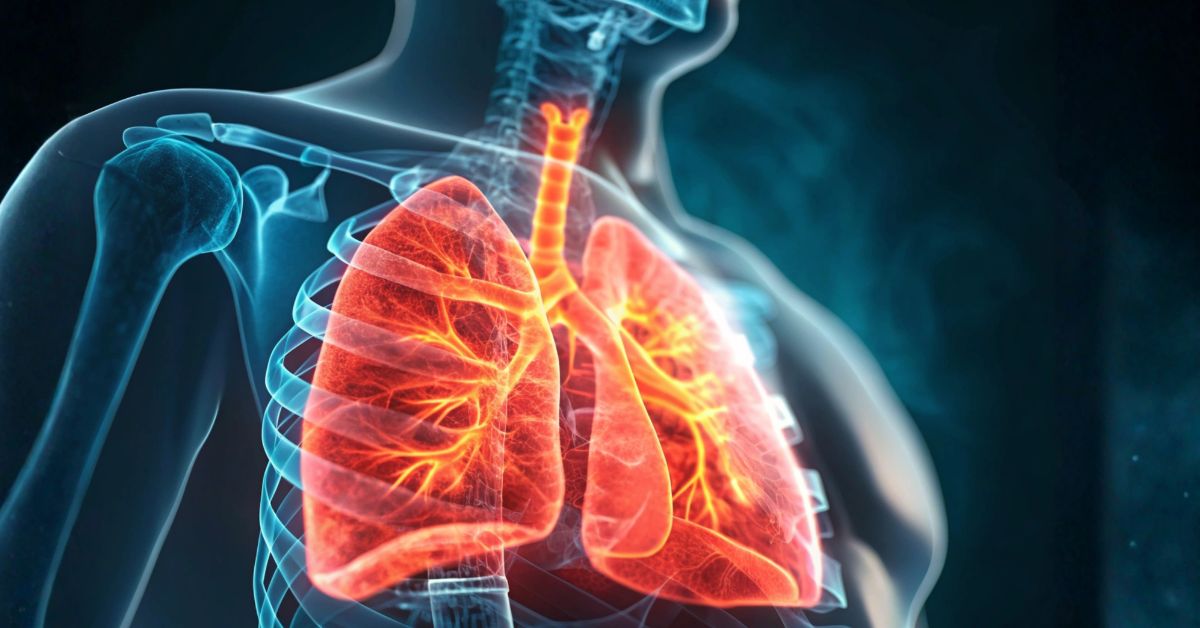 Health Screening - Smoker's Screening Package